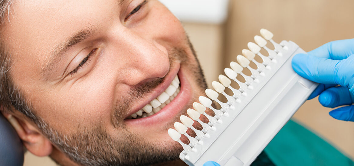 doctor showing a male patient a color palette for a cosmetic dental treatment