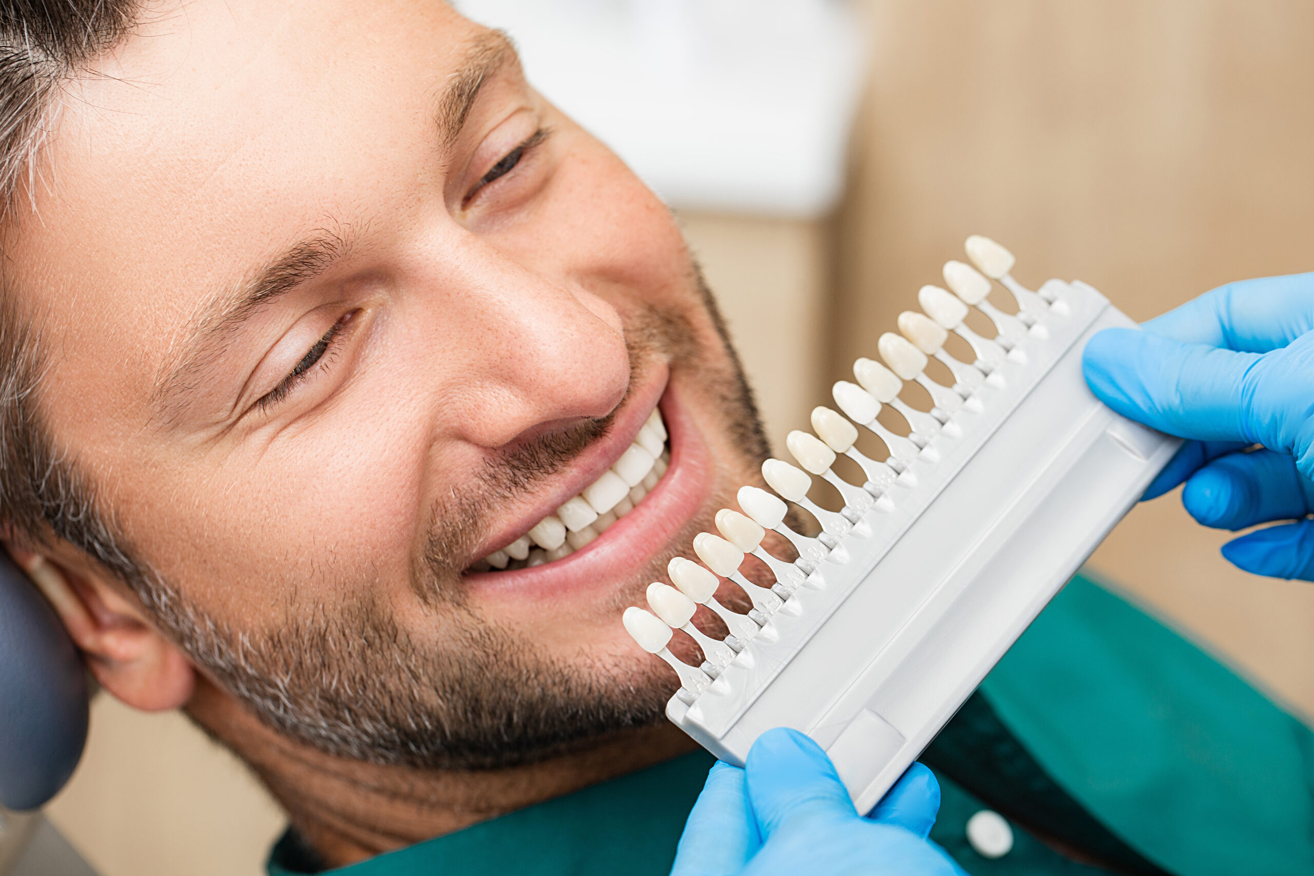 doctor showing a male patient a color palette for a cosmetic dental treatment