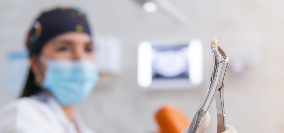 doctor holding up an extracted tooth in Staten Island