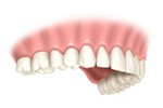 Care and use of dental tooth implants - Staten Island, New York